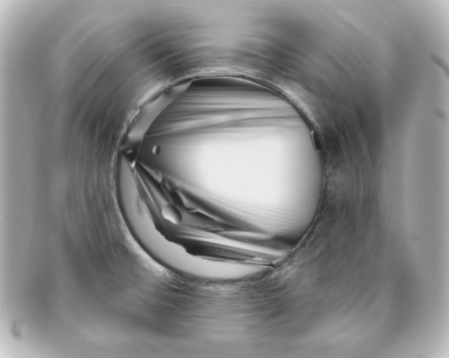 X0000098151476200805081031