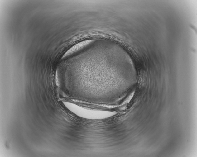 X0000098151490200805081030