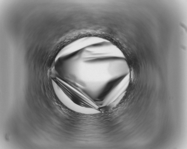 X0000098151492200805081030
