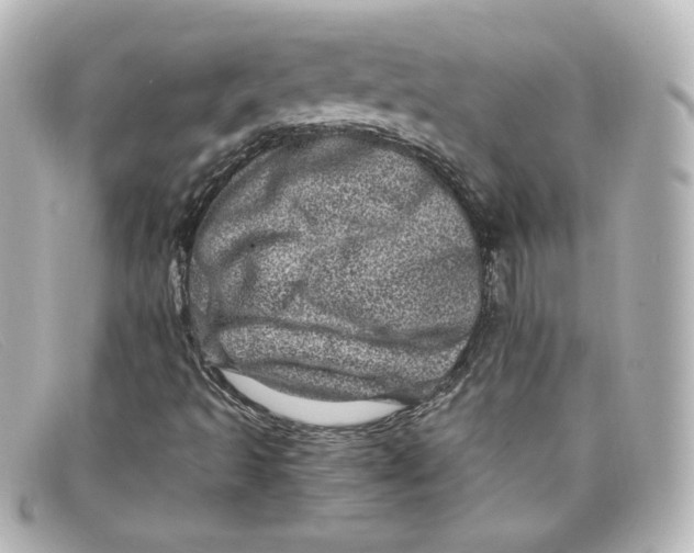 X0000098151493200805081030