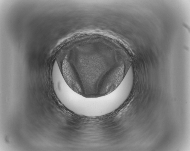 X0000098151494200805081030