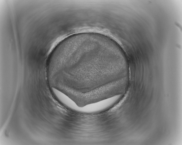 X0000098151501200805081030