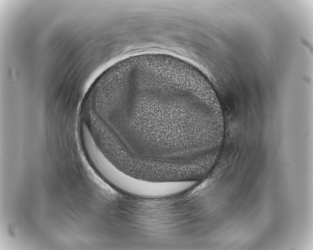 X0000098151518200805081031