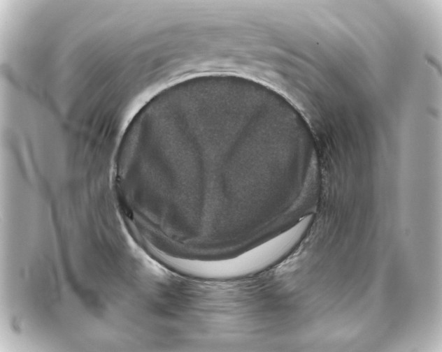 X0000098151527200805081031