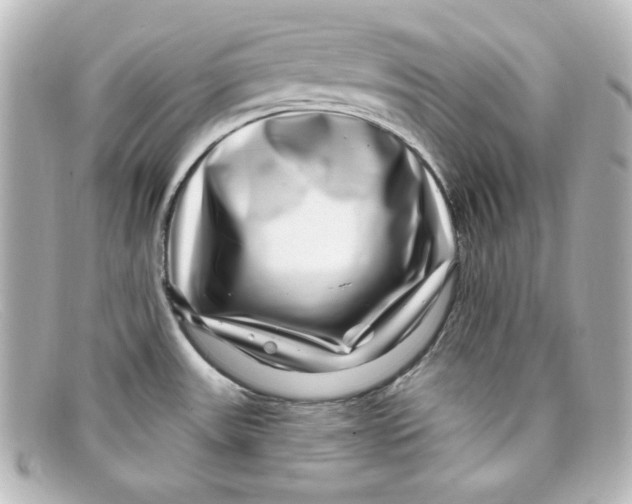 X0000098151531200805081031