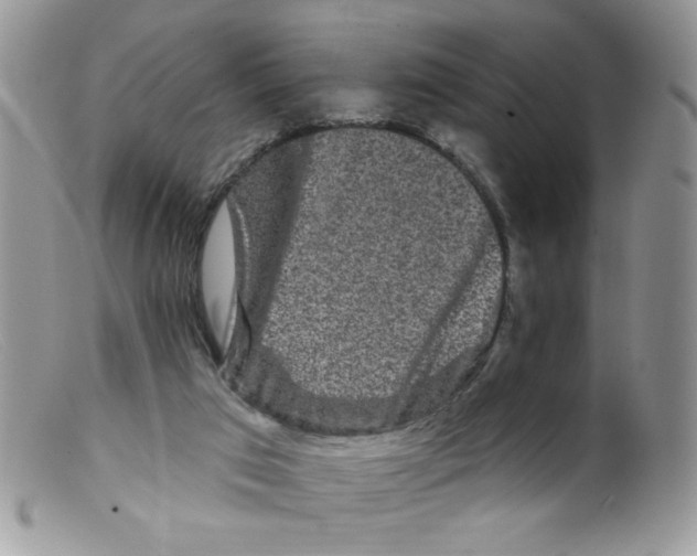 X0000098150017200805151216