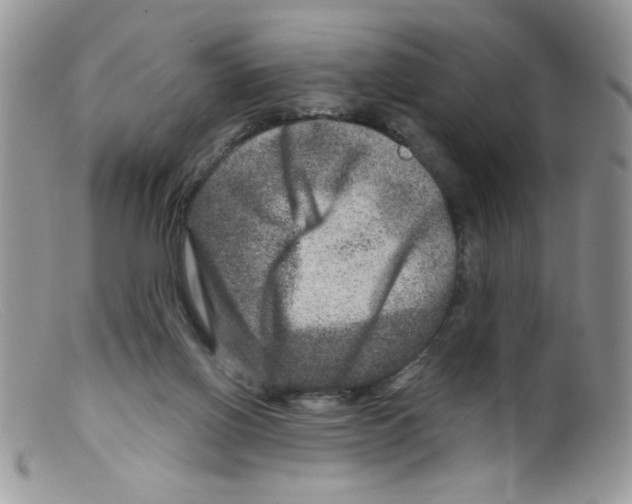 X0000098150070200805151215