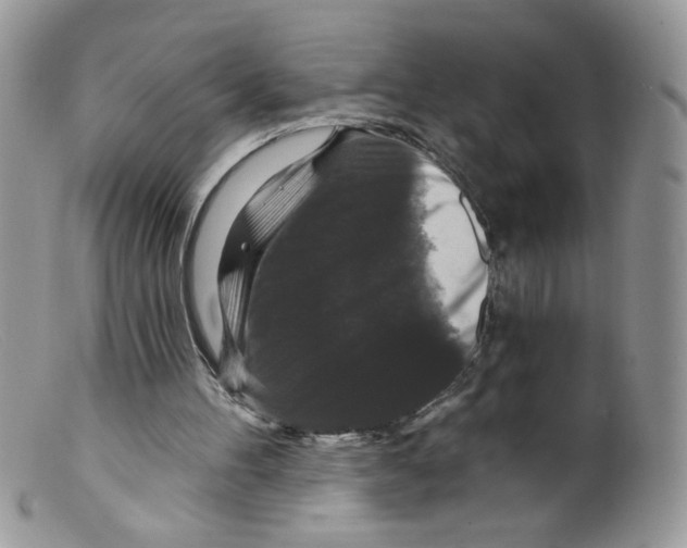 X0000098150100200805151215