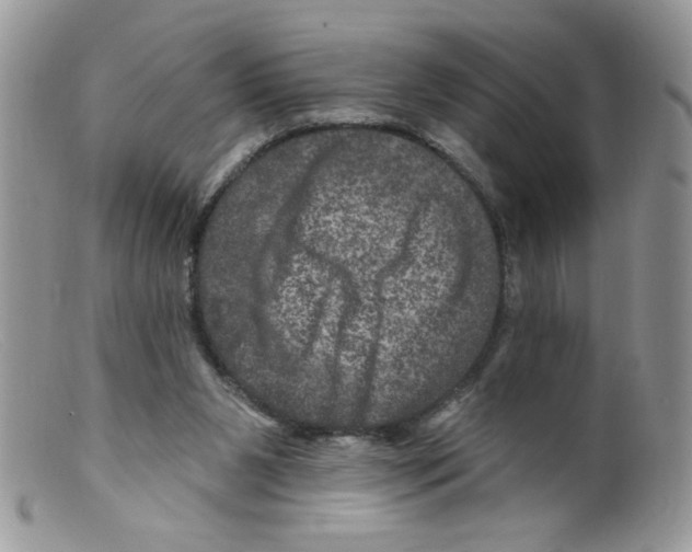 X0000098150111200805151214