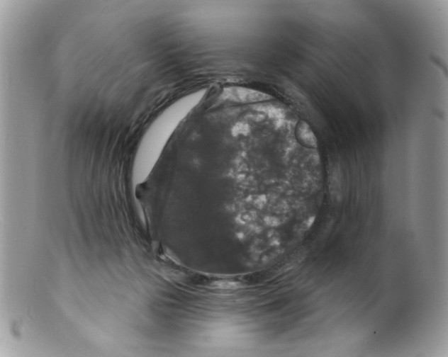 X0000098150169200805151213