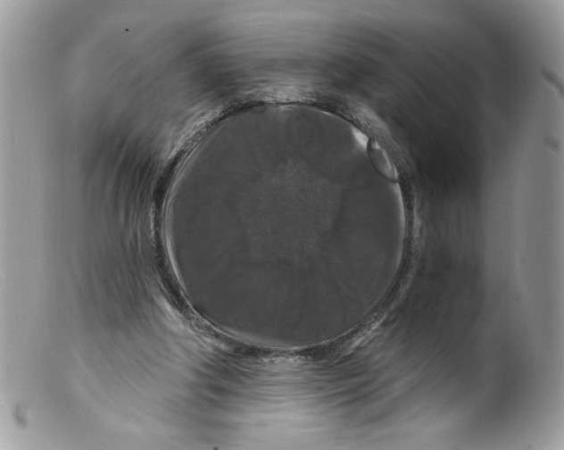 X0000098150202200805151213