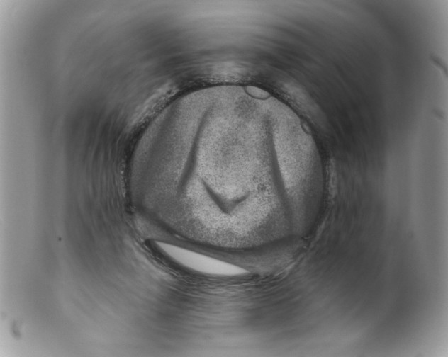 X0000098150258200805151212