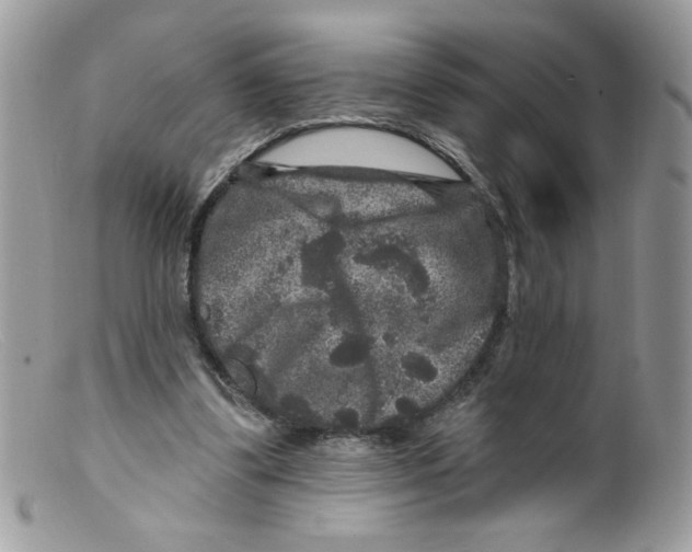 X0000098150299200805151211