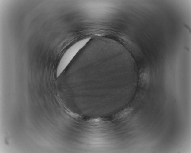 X0000098150325200805151211