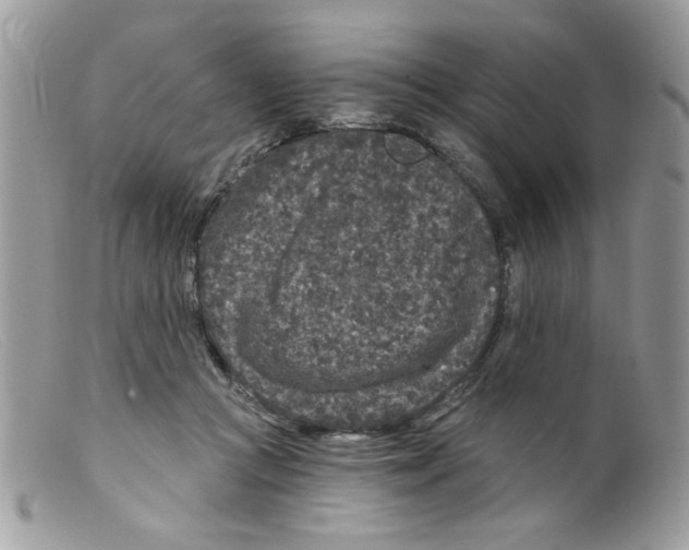 X0000098150361200805151210