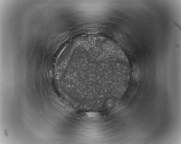 X0000098150371200805151210