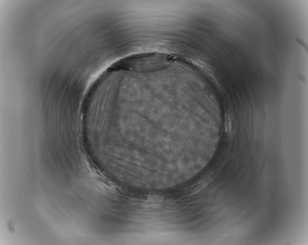 X0000098150388200805151210