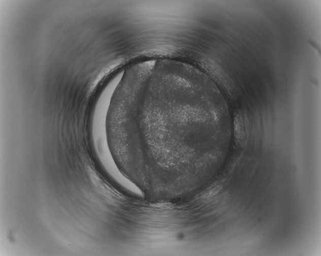 X0000098150396200805151210