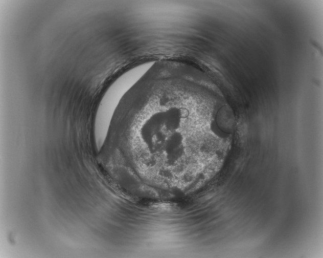 X0000098150499200805151208
