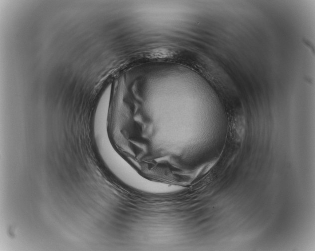 X0000098150556200805151207