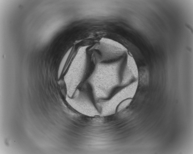 X0000098150574200805151207