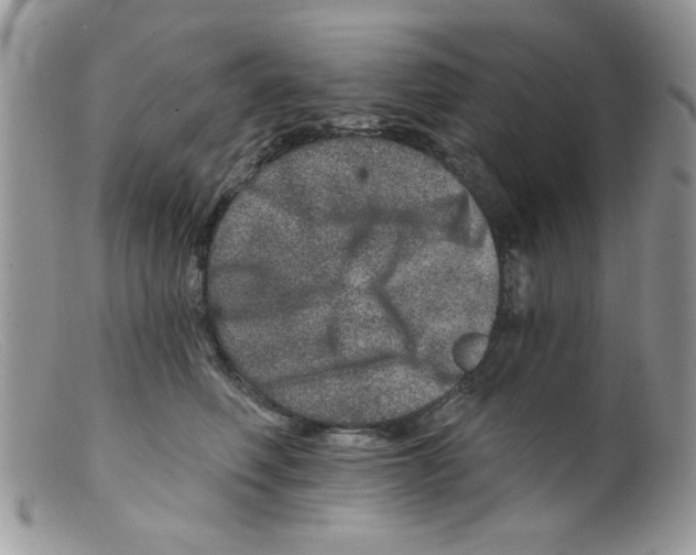 X0000098150614200805151206
