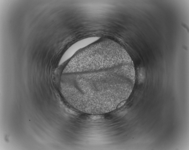 X0000098150619200805151206