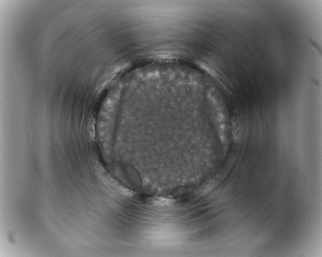 X0000098150718200805151205