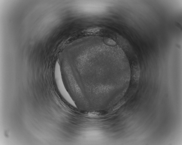 X0000098150758200805151205