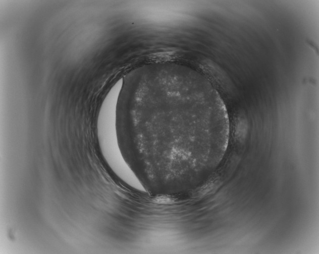 X0000098150759200805151205