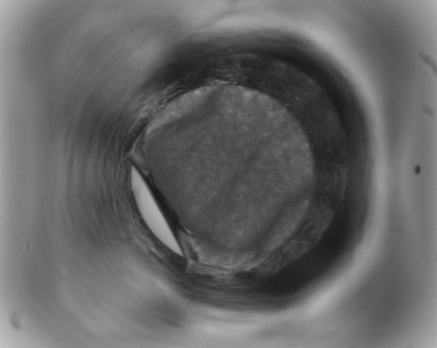 X0000098150766200805151205