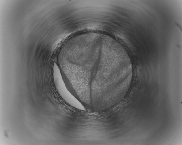 X0000098150776200805151204