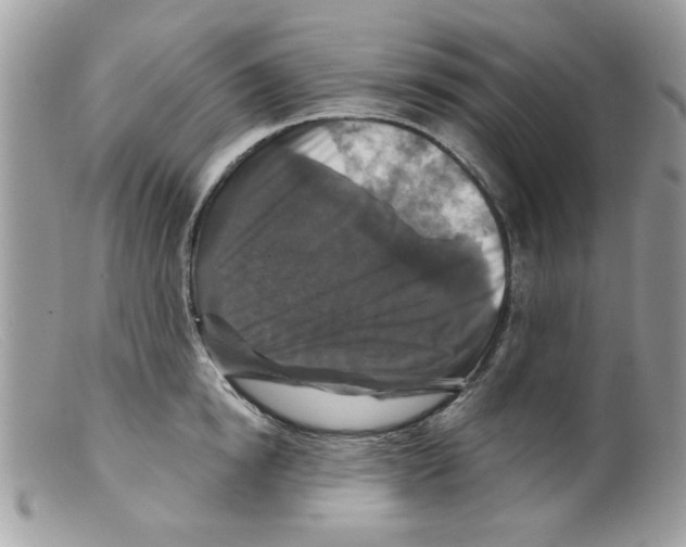 X0000098150854200805151203