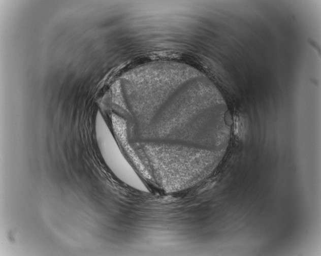 X0000098150915200805151201