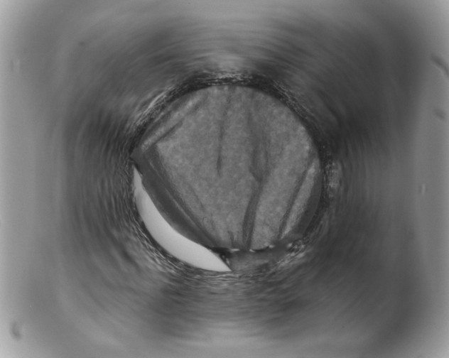 X0000098150916200805151201