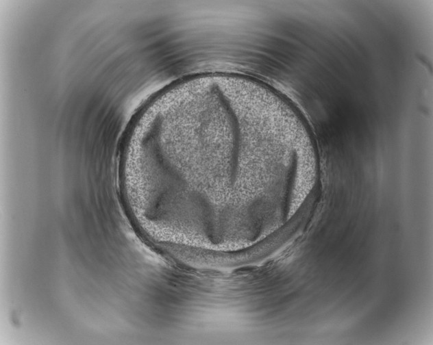 X0000098150987200805151201