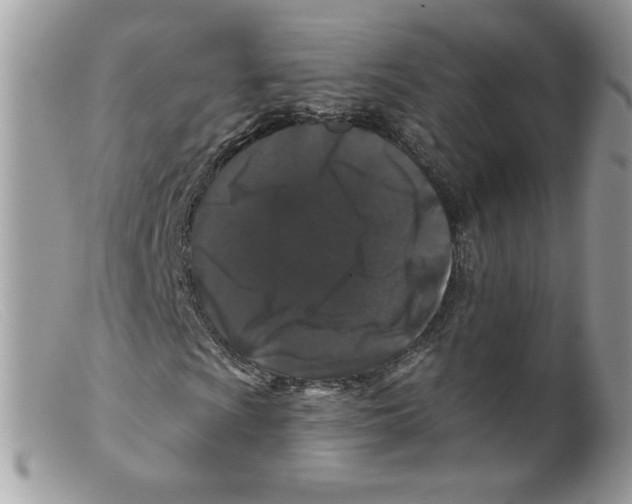 X0000098151009200805151159