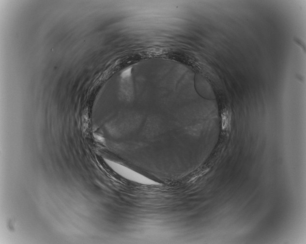 X0000098151011200805151159