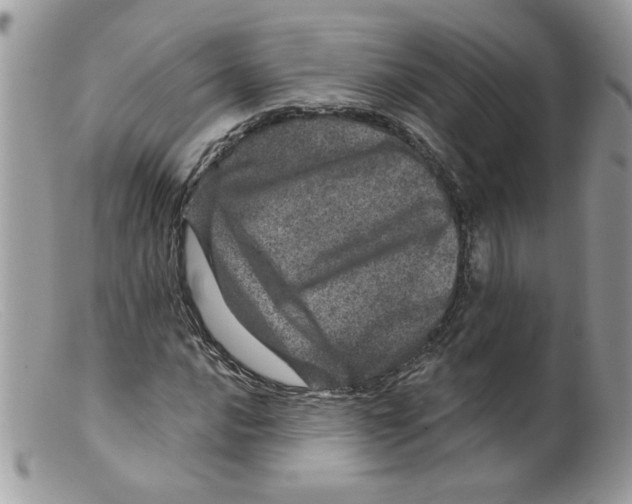 X0000098151016200805151159