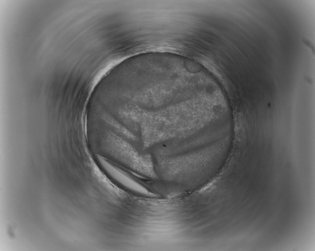 X0000098151032200805151200