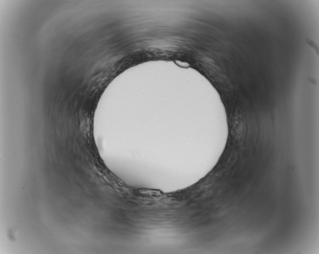X0000098151061200805151159