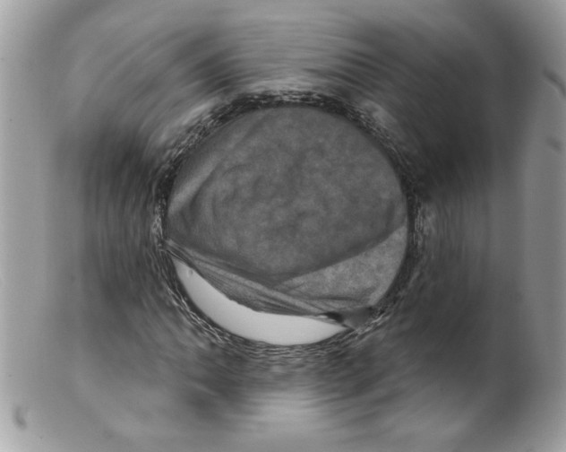 X0000098151062200805151159