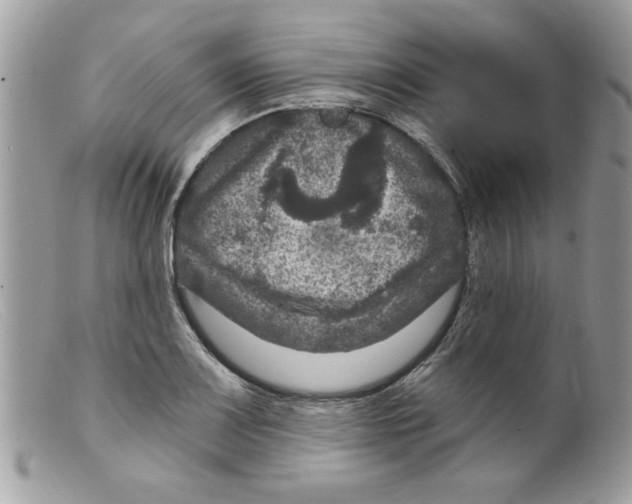 X0000098151083200805151159