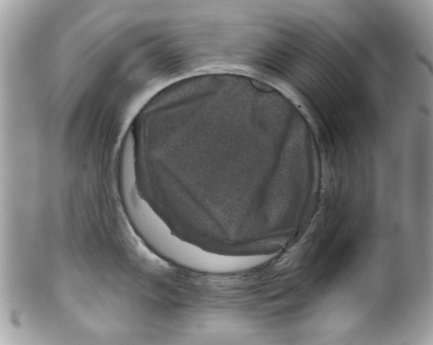 X0000098151102200805151159
