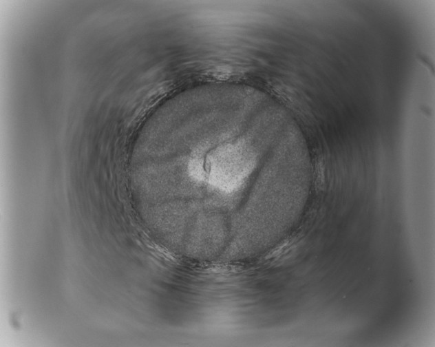 X0000098151105200805151158
