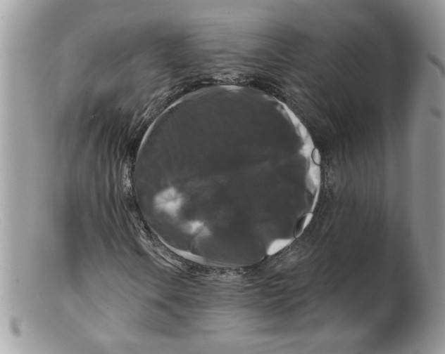 X0000098151106200805151158