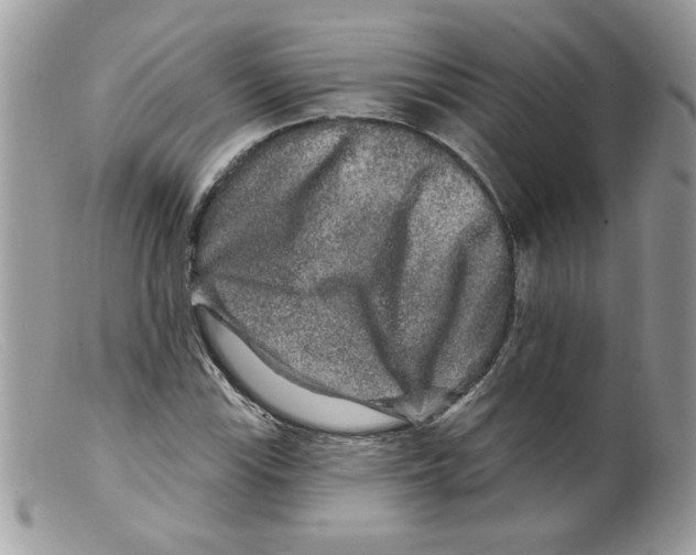 X0000098151115200805151158