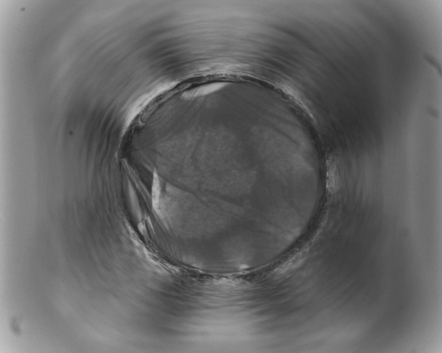 X0000098151117200805151158