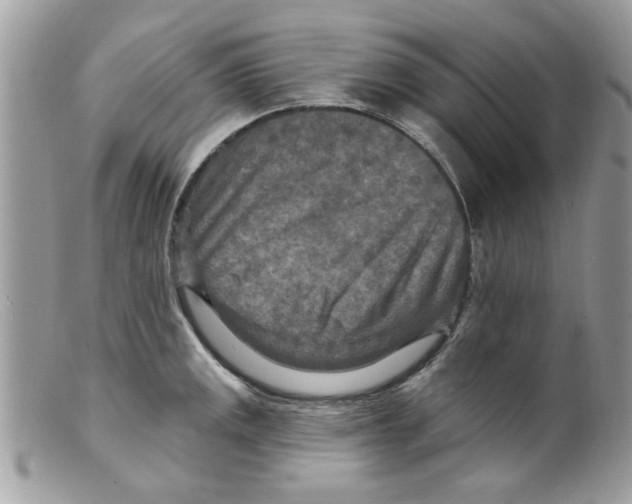X0000098151141200805151158