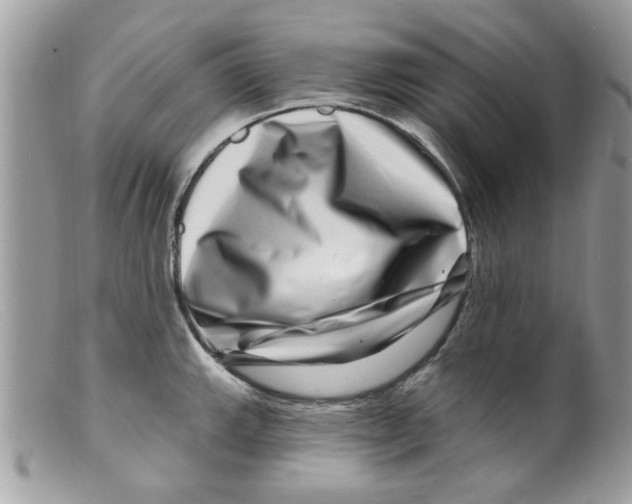 X0000098151143200805151158
